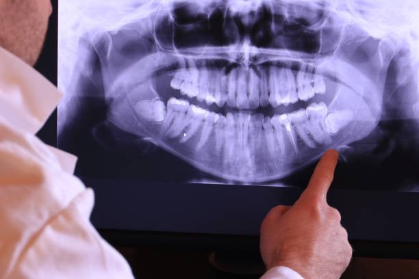 Best Weekend Emergency Dentist in Six Mile, SC