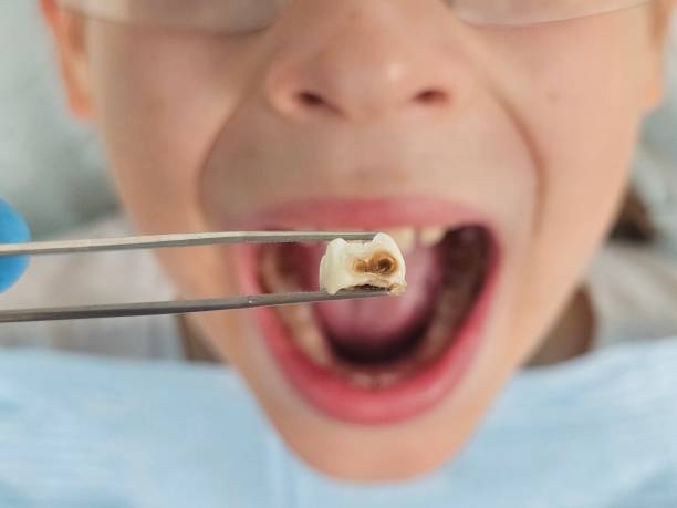 Best Same-Day Emergency Dentist in Six Mile, SC